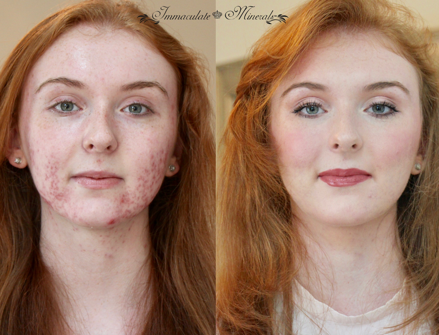 THE IMMACULATE TRANSFORMATIONS